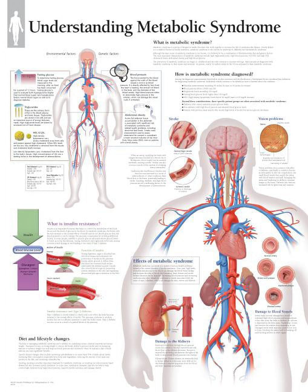 Understanding Metabolic Syndrome