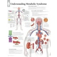 thumbnail image 1 of Metabolic Syndrome Chart: Wall Chart (Other), 1 of 8