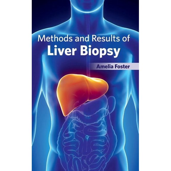 Methods and Results of Liver Biopsy, (Hardcover)