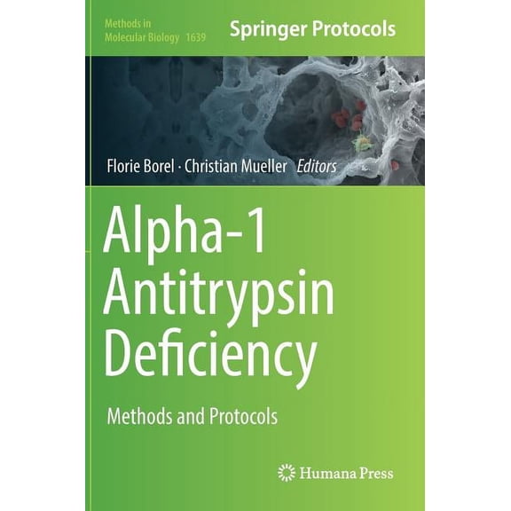 Methods in Molecular Biology Alpha-1 Antitrypsin Deficiency: Methods and Protocols, Book 1639, (Hardcover)