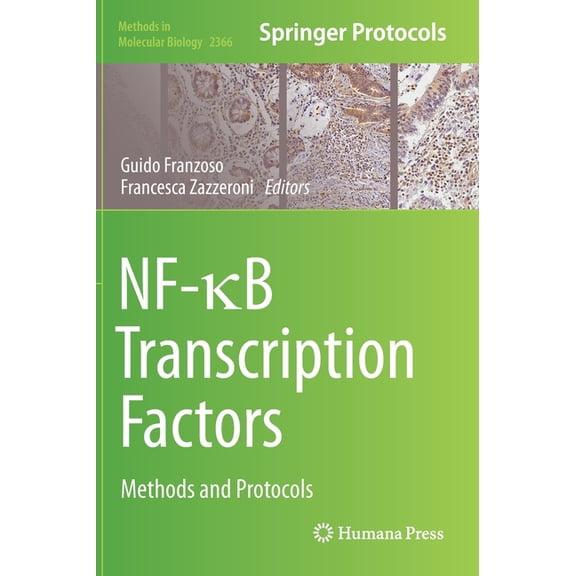 Methods in Molecular Biology Nf-b Transcription Factors: Methods and Protocols, Book 2366, (Hardcover)