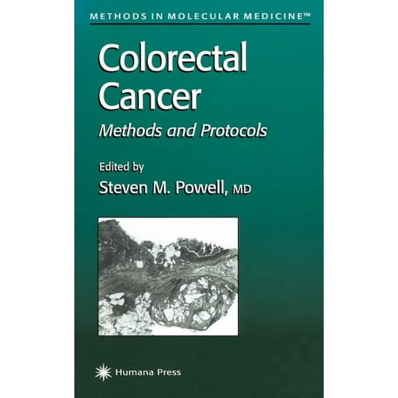 Methods in Molecular Medicine Colorectal Cancer: Methods and Protocols, Book 50, (Hardcover)