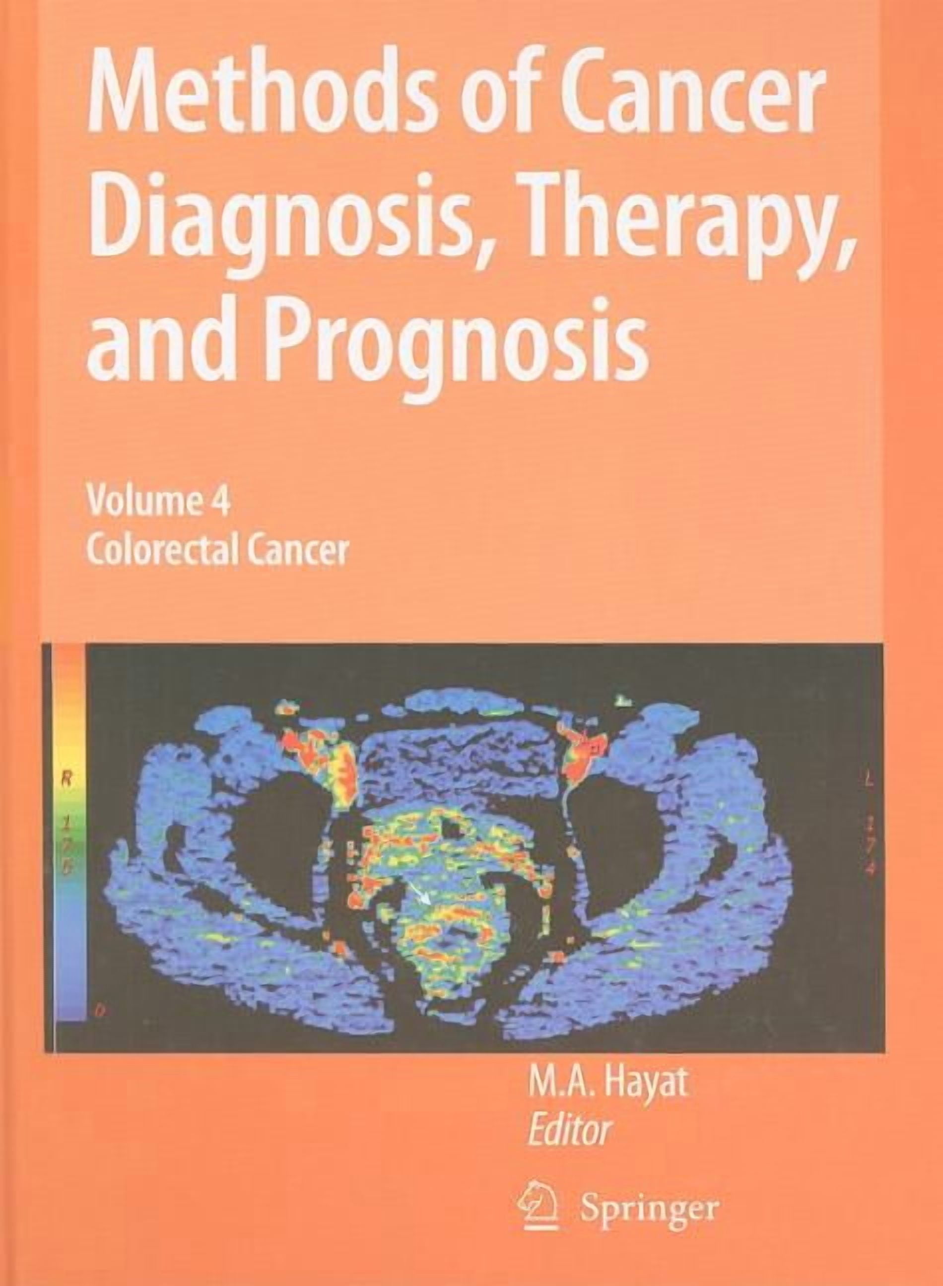 Methods of Cancer Diagnosis, Therapy and Methods of Cancer Diagnosis ...
