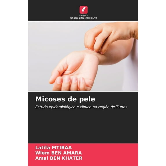 Micoses de pele (Paperback)