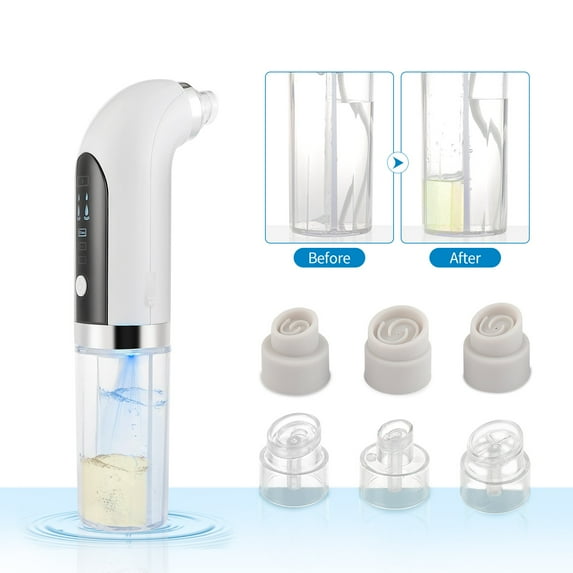 Microbubble Blackhead Remover Pore Vacuum Cleaner Water Cycle Acne Pimple Black Dot Removal Electric Pore Cleaner Vacuum Suction