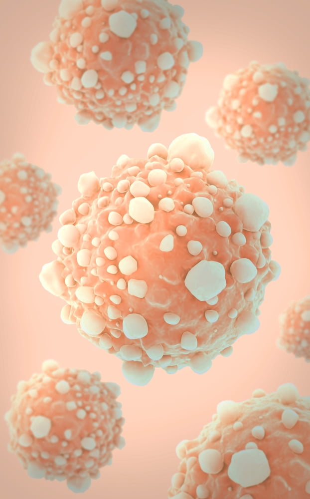Microscipic view of pancreatic cancer cells Canvas Art - Stocktrek Images (12 x 18)