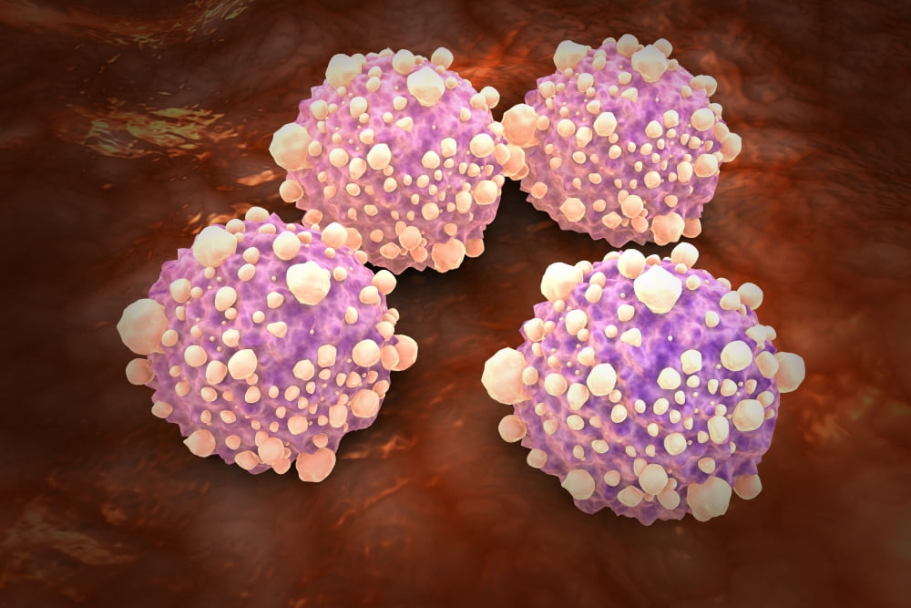 Microscipic view of pancreatic cancer cells Canvas Art - Stocktrek Images (18 x 12)