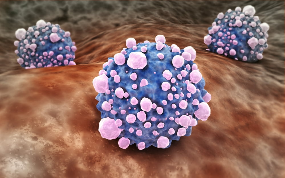 Microscipic view of pancreatic cancer cells Canvas Art - Stocktrek Images (18 x 12)
