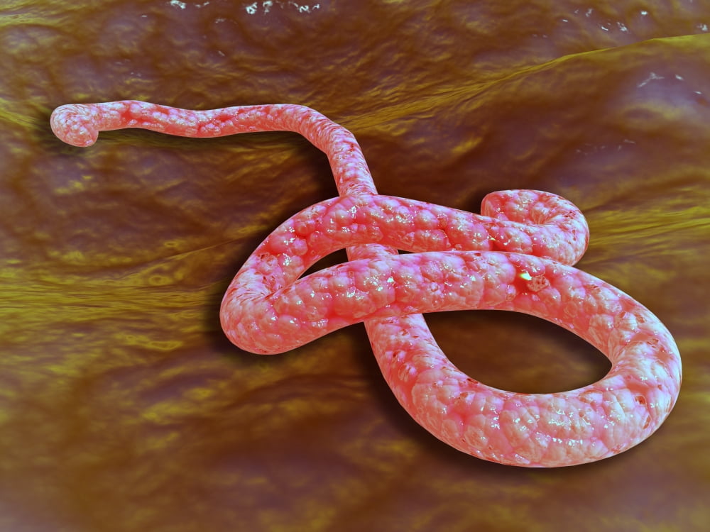 Microscopic view of Ebola virus Canvas Art - Stocktrek Images (33 x 25)
