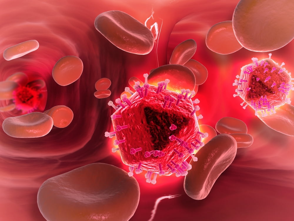 Microscopic view of HIV virus inside the lungs Canvas Art - Stocktrek Images (33 x 25)