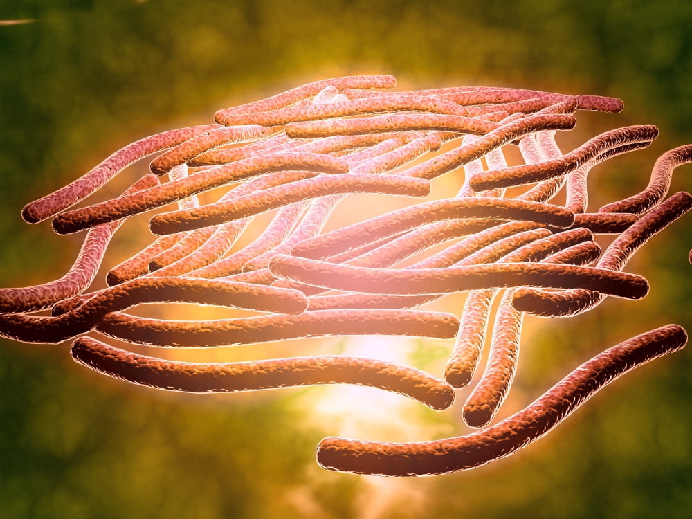 Microscopic view of Legionella pneumophila Canvas Art - Stocktrek Images (17 x 13)
