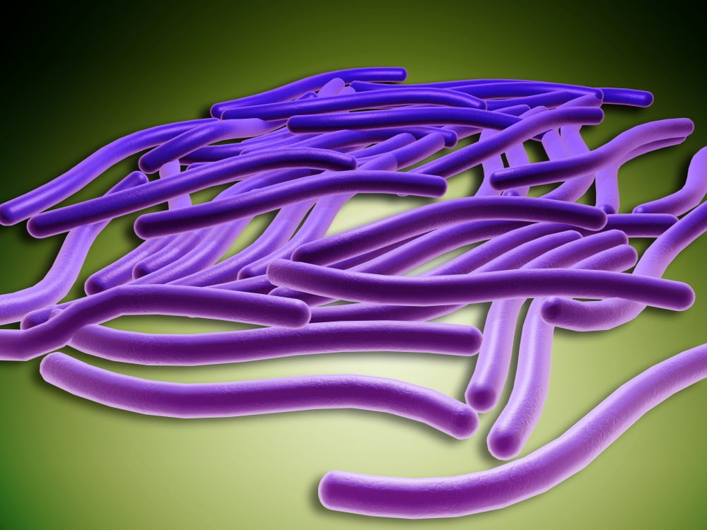 Microscopic view of Legionella pneumophila Canvas Art - Stocktrek Images (33 x 25)
