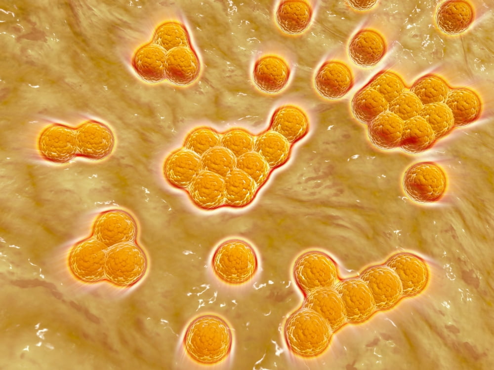 Microscopic view of Methicillin-resistant Staphylococcus aureus Canvas Art - Stocktrek Images (33 x 25)