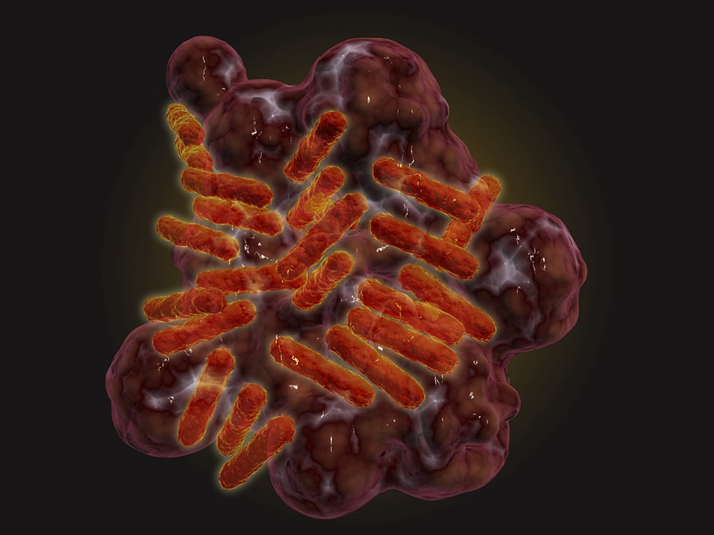 Microscopic view of Rickettsia Canvas Art - Stocktrek Images (17 x 13)