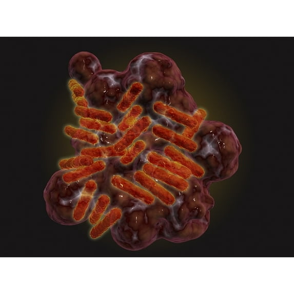 Microscopic view of Rickettsia Poster Print