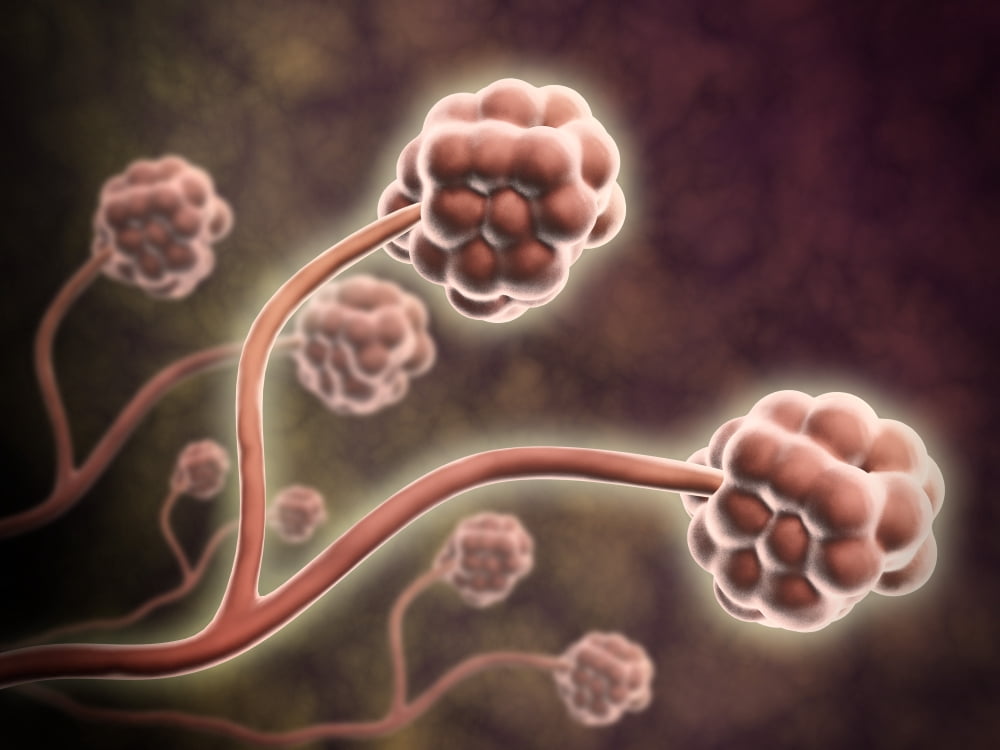 Microscopic view of Stachybotrys chartarum Canvas Art - Stocktrek Images (33 x 25)