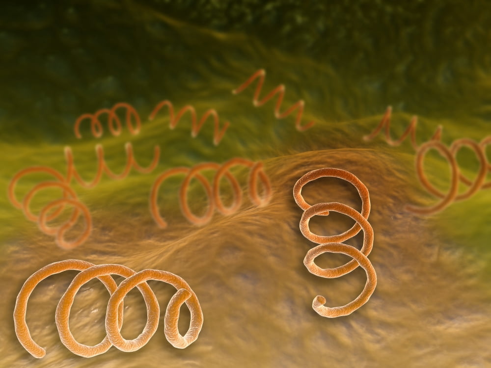Microscopic view of Syphillis Canvas Art - Stocktrek Images (33 x 25)