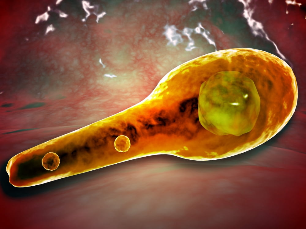 Microscopic view of Tetanus Canvas Art - Stocktrek Images (17 x 13)