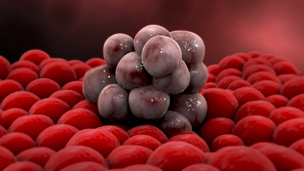 Microscopic view of a tumor Canvas Art - Stocktrek Images (38 x 22)