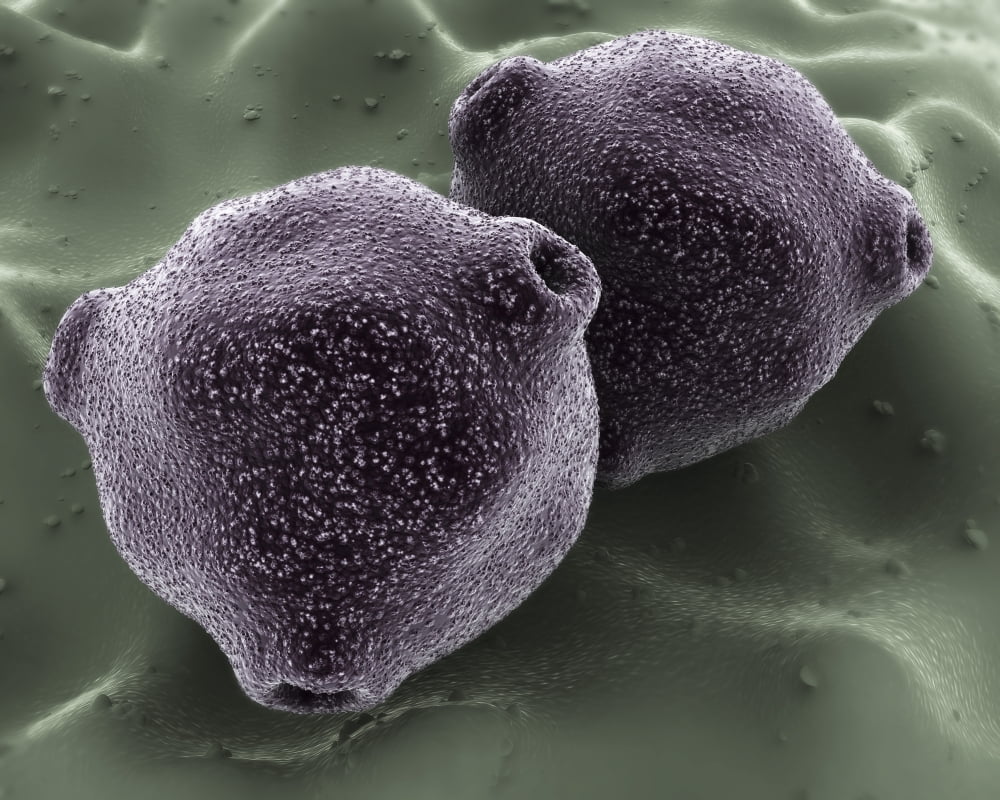 Microscopic view of birch tree pollen Canvas Art - Stocktrek Images (16 x 13)