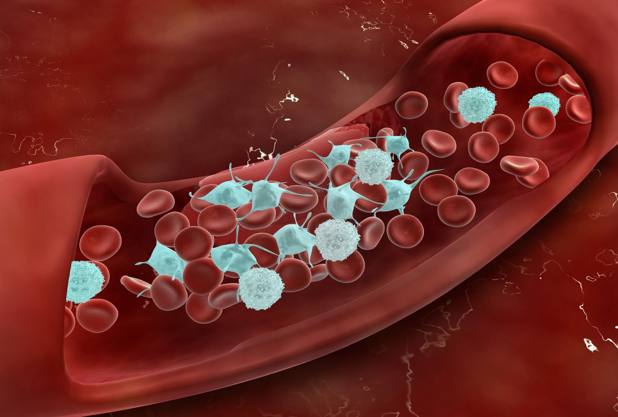Microscopic view of blood clotting inside the artery Canvas Art - Stocktrek Images (17 x 12)