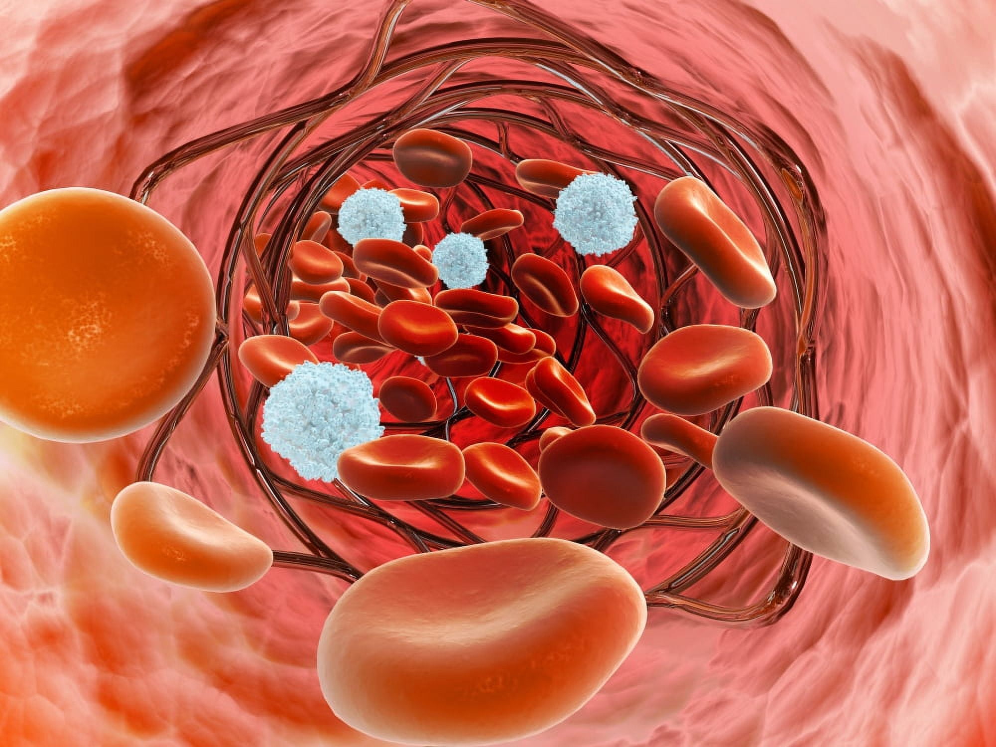 Microscopic view of blood flow inside an artery with stent deployment Canvas Art - Stocktrek Images (17 x 13)