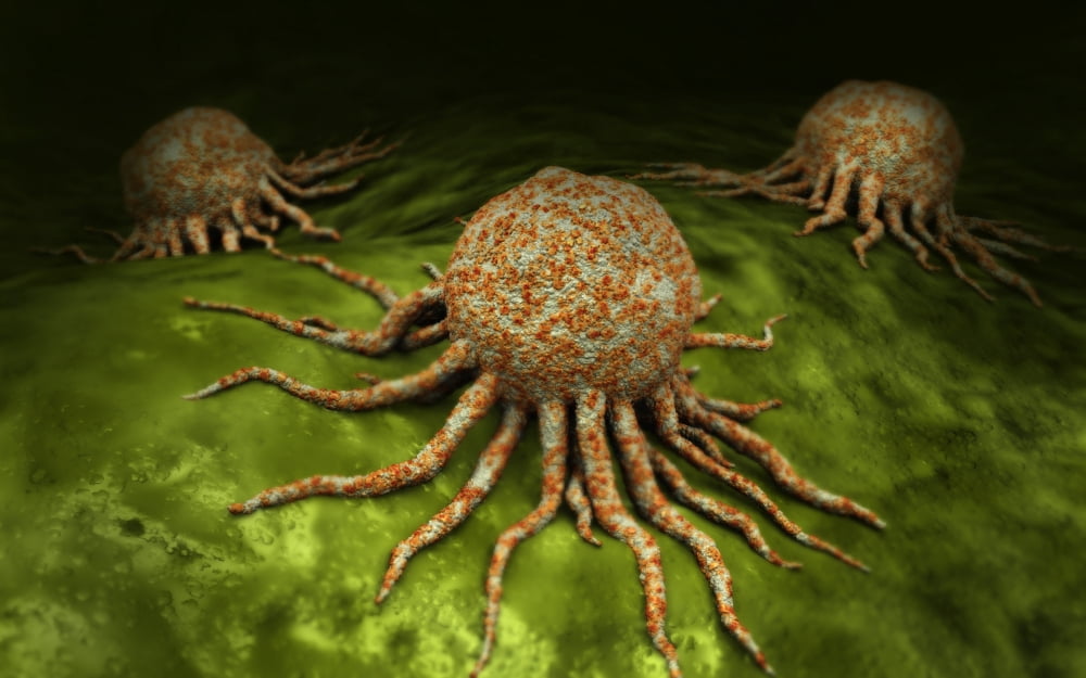 Microscopic view of cancer virus Canvas Art - Stocktrek Images (18 x 12)