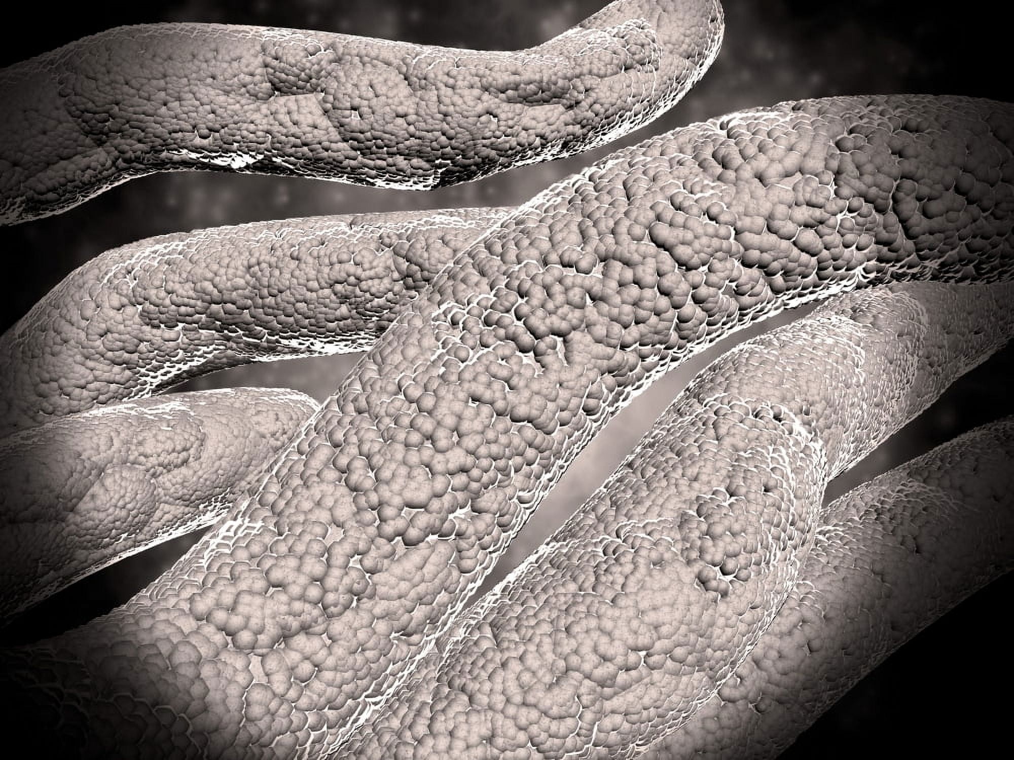 Microscopic view of corncob formation in dental plaque Canvas Art - Stocktrek Images (17 x 13)