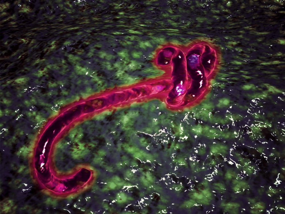 Microscopic view of ebola virus Canvas Art - Stocktrek Images (33 x 25)
