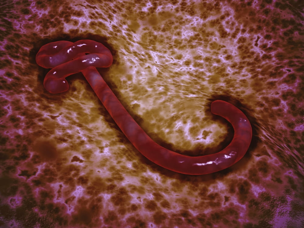 Microscopic view of ebola virus Canvas Art - Stocktrek Images (33 x 25)