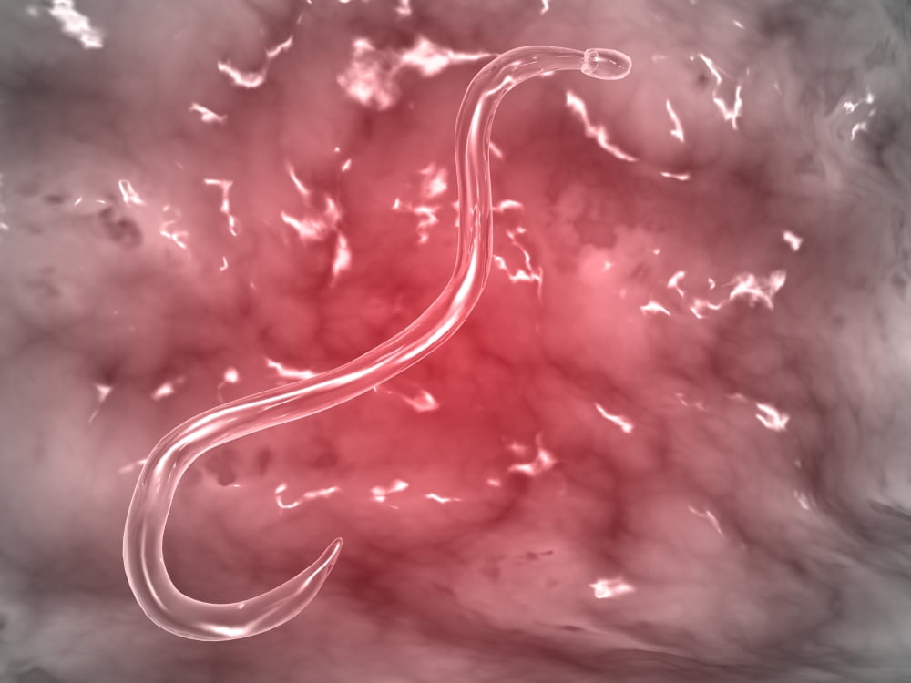 Microscopic view of hookworm Canvas Art - Stocktrek Images (17 x 13)