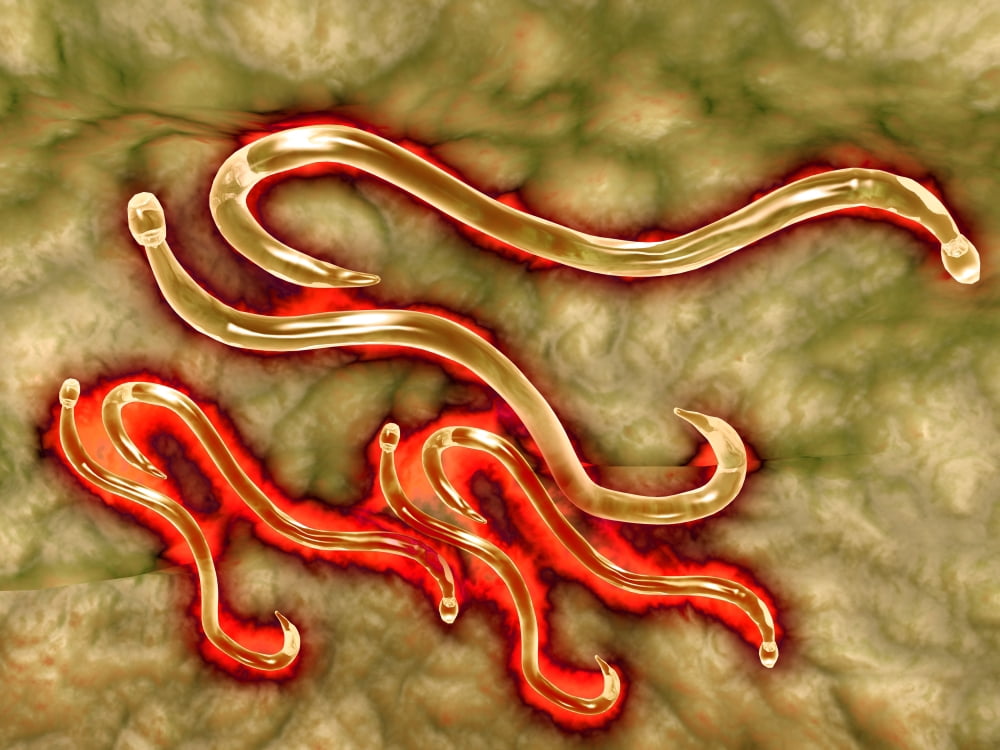 Microscopic view of hookworm Canvas Art - Stocktrek Images (33 x 25)