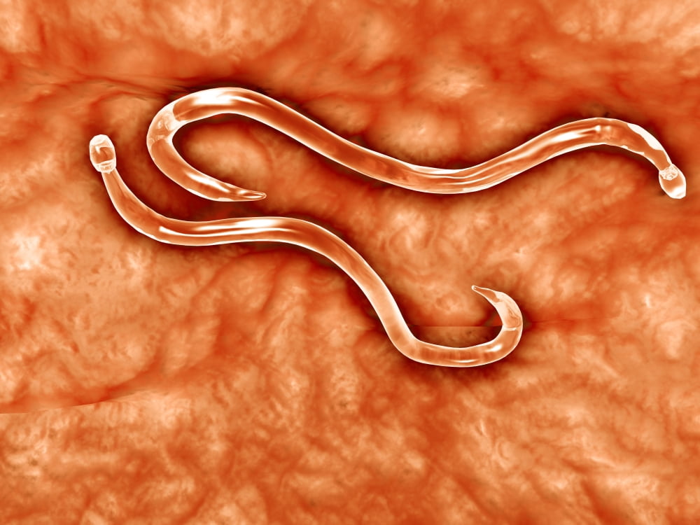 Microscopic view of hookworm Canvas Art - Stocktrek Images (33 x 25)