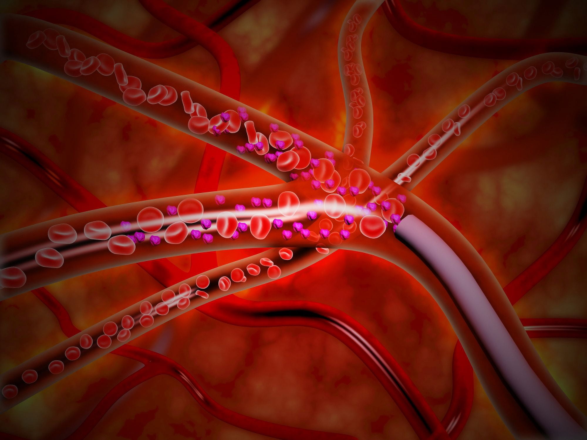 Microscopic view of medicine being injected inside the artery Canvas Art - Stocktrek Images (33 x 25)