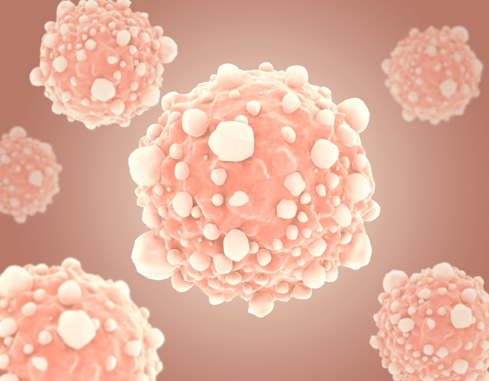 Microscopic view of pancreatic cancer cell Canvas Art - Stocktrek Images (33 x 25)