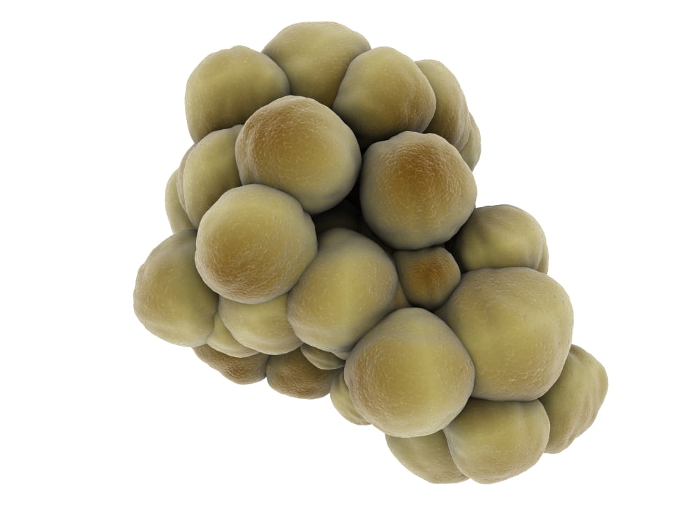 Microscopic view of tumor Canvas Art - Stocktrek Images (17 x 13)