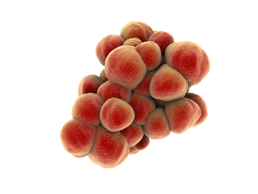 Microscopic view of tumor Canvas Art - Stocktrek Images (33 x 25)