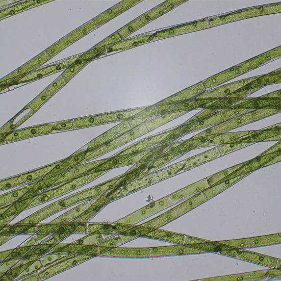 Microspora, Living Green Algae Culture, Sufficient Materials For 30 Students