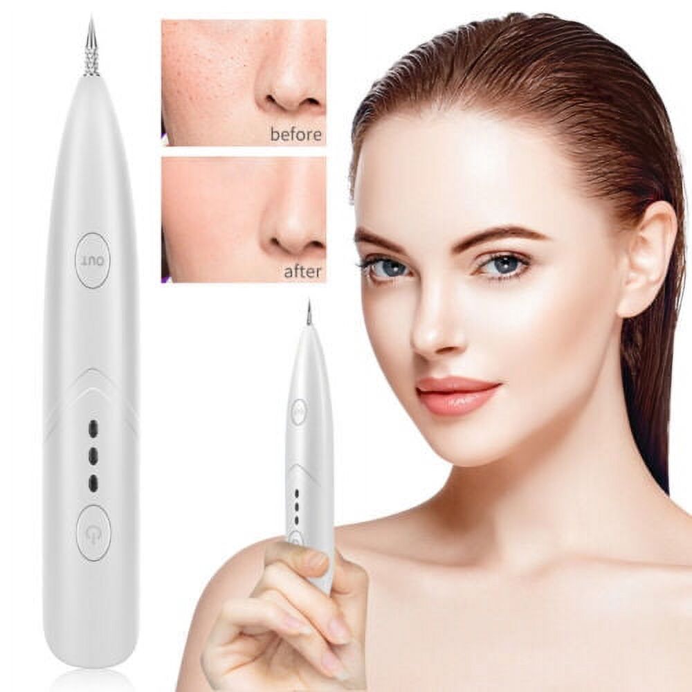 Mieauty Plasma Mole Removal Pen Freckle Wart Removal Pen Dark Remover