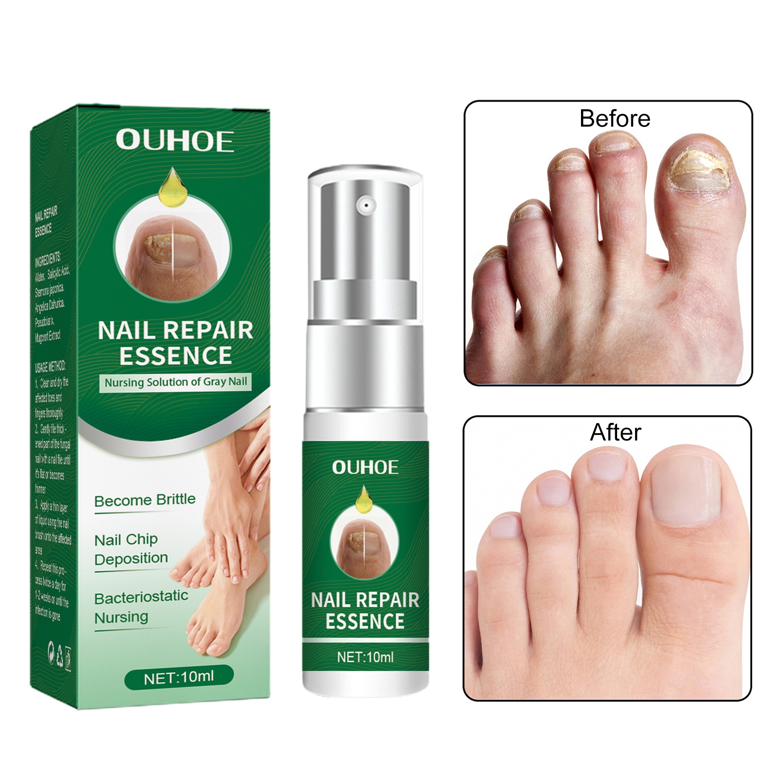 Mightlink 10ml Nail Repair Essence Fast Healing Gently Smoothing Anti ...