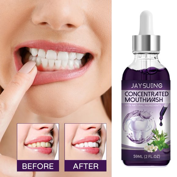 Miss Mouth Stain Remover