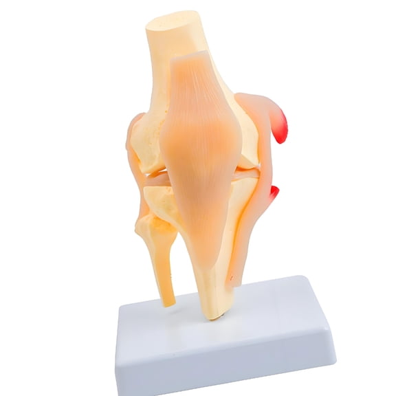 Miiottaa Professional Anatomical Patella Knee Joint Model With Muscles Ligaments For Patient Communication And Clinical Training