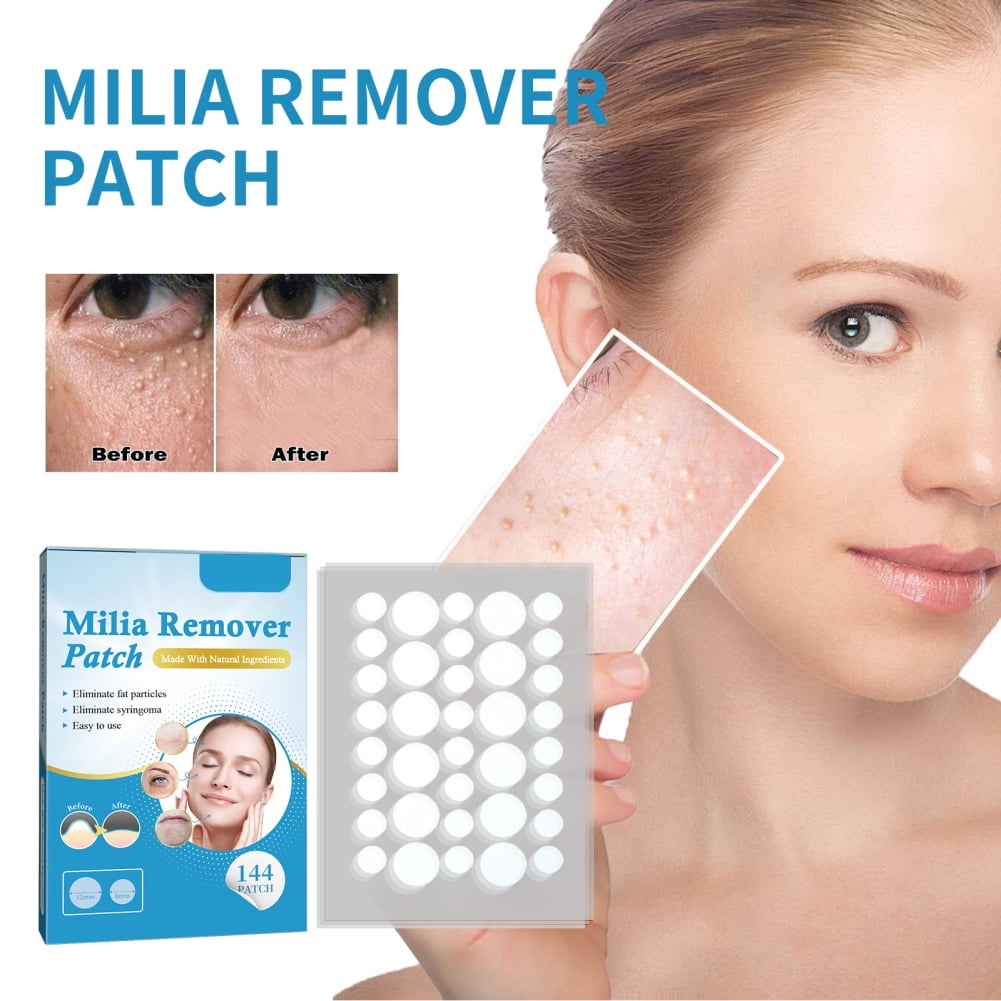 Milia Remover Patches For Milia Spot Treatment Soften Stick Remove The