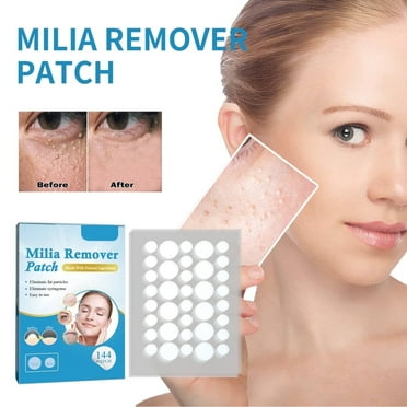 Milia Remover Patches For Milia Spot Treatment Soften Stick Remove The Subcutaneous Mass Of The Face Fat Granule Plain Sweat Tube Granule Repair Stick