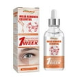 thumbnail image 1 of Milia Remover Serum Milia Spot Treatment Helps Dissolve Oil and Reduce Bump Q4K0, 1 of 1