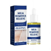 Milia Remover Serum, Milia Spot Treatment Helps Dissolve and Reduce Milia, Whitehead, and Sebaceous Hyperplasia (1 pcs)