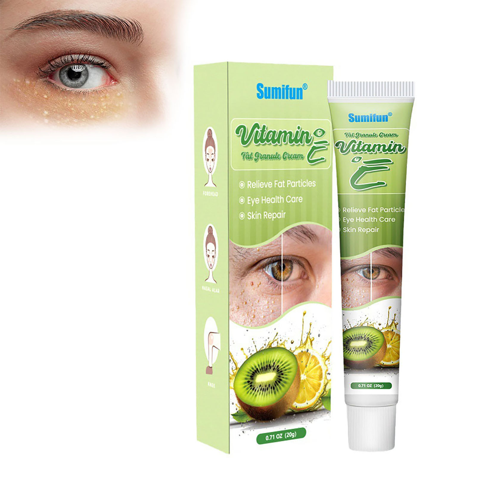 Milia Seed Removal Cream Reduce Puffiness Remove Fat Granule Night