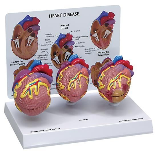 Mini Heart Set of 3 GPI Anatomical Models LFA#2550. Make Us an Offer . See VIDEO