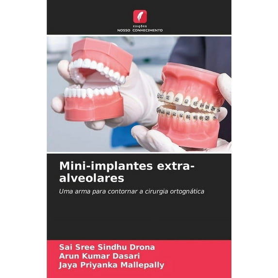 Mini-implantes extra-alveolares, (Paperback)