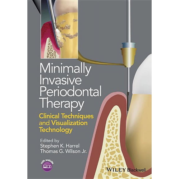 Minimally Invasive Periodontal Therapy: Clinical Techniques and Visualization Technology (Paperback)